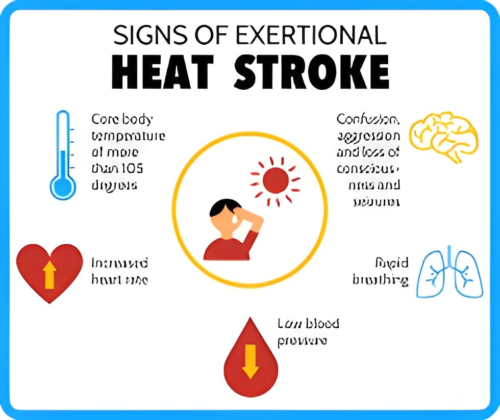 FAQs about Heat Storks