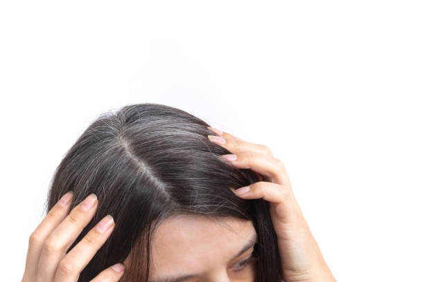 Homeopathy treatment for greying hair